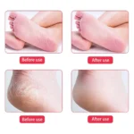 Double-Side Foot Dead Skin Remover - Image 4