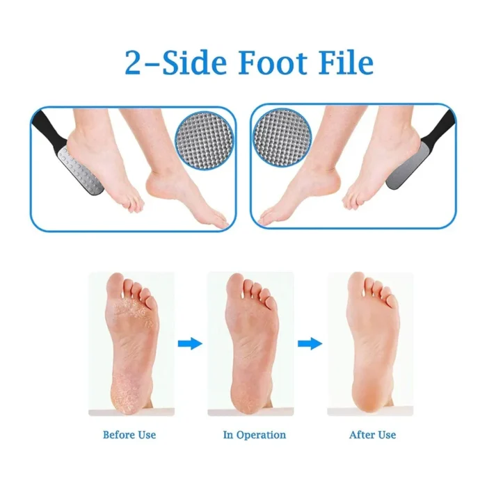 Double-Side Foot Dead Skin Remover - Image 8